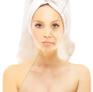 Laser Skin Resurfacing Lewisville, TX