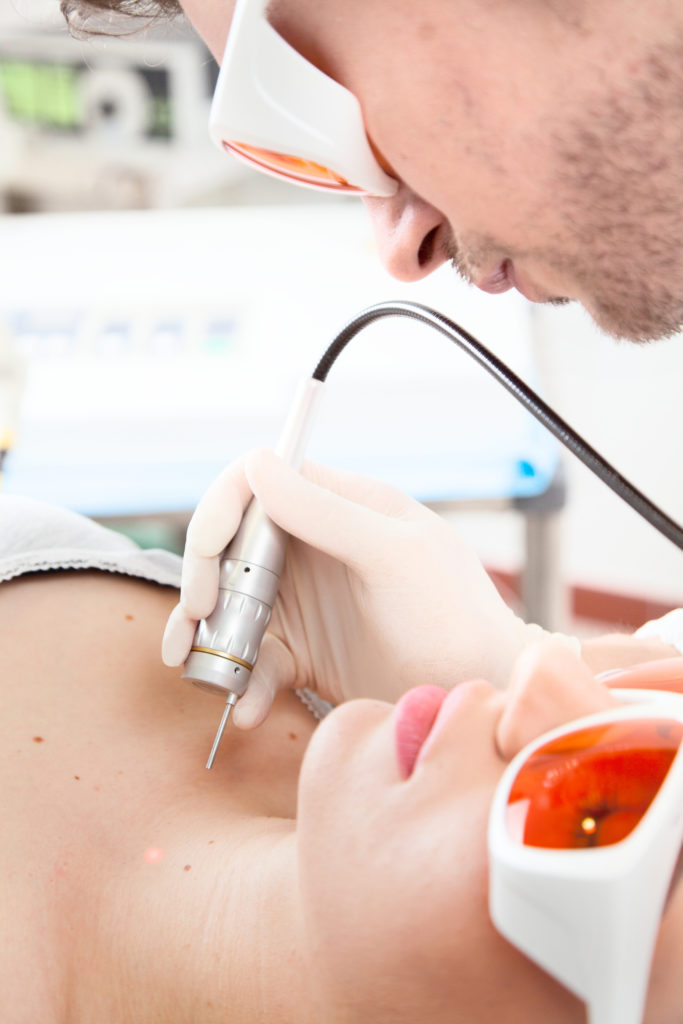 Laser Skin Resurfacing Lewisville TX | Skin Resurfacing Dallas TX