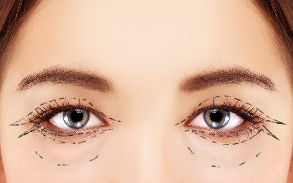 Lower Blepharoplasty Lewisville TX | Upper Blepharoplasty Dallas TX