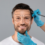 Surgeon hands making marks on smiling man face.