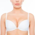 Breast augmentation