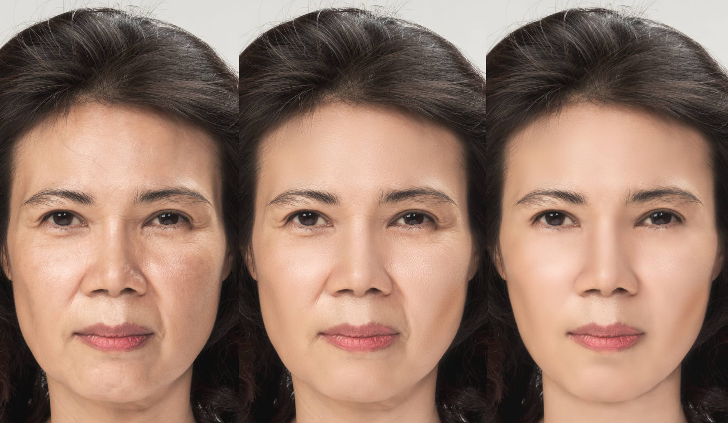 Anti Aging process, Asian woman face skin with anti aging procedures, rejuvenation, lifting, tightening of facial skin, restoration of youthful skin anti wrinkle. Old and young concept.