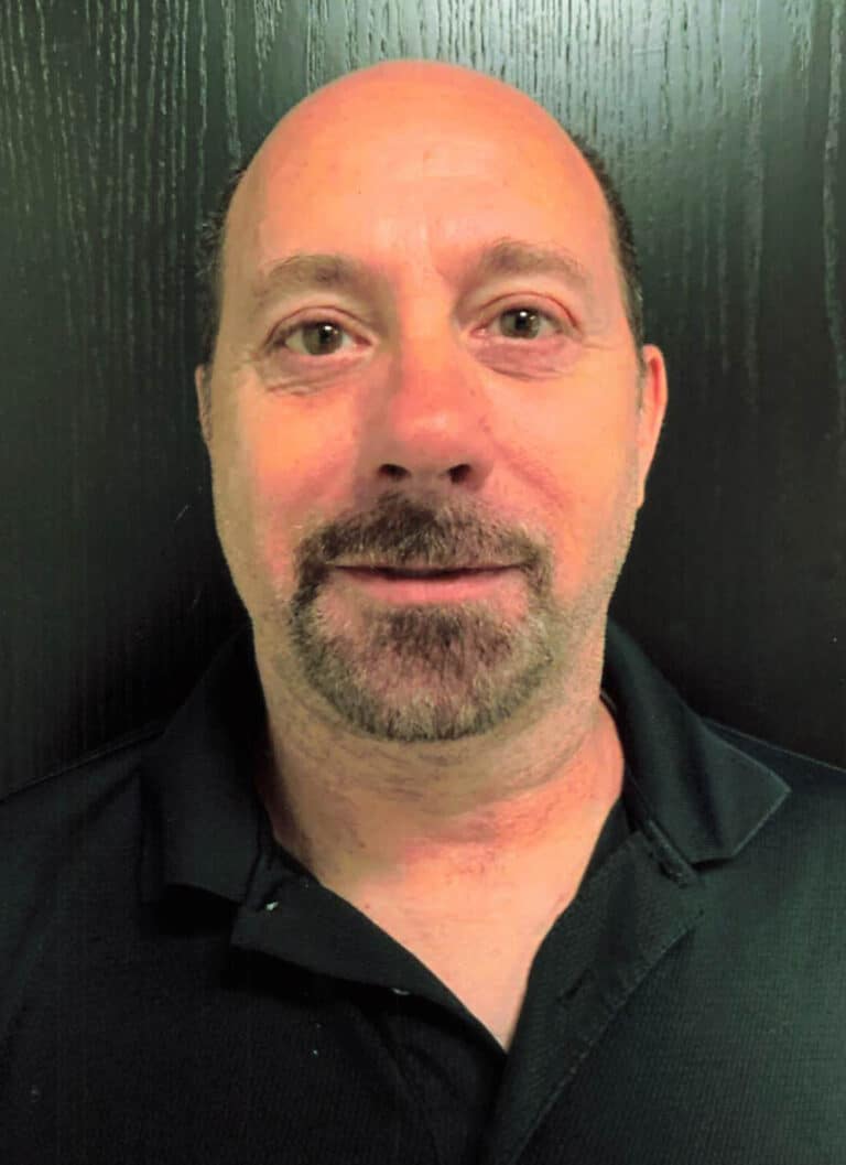 After Image: Lower Blepharoplasty - front