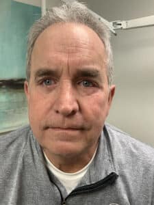 After Image: Eyes