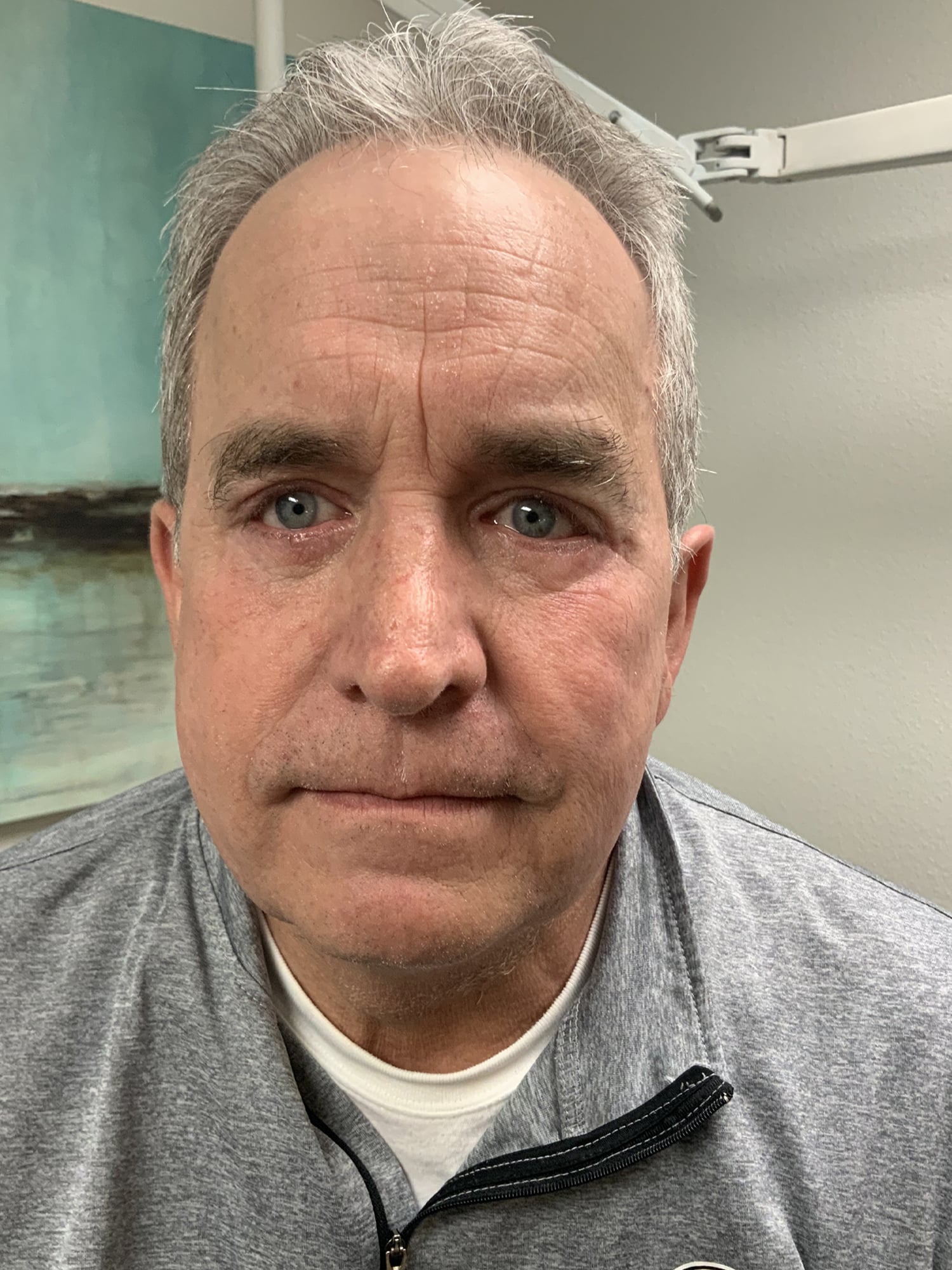 After Image: Eyes - front